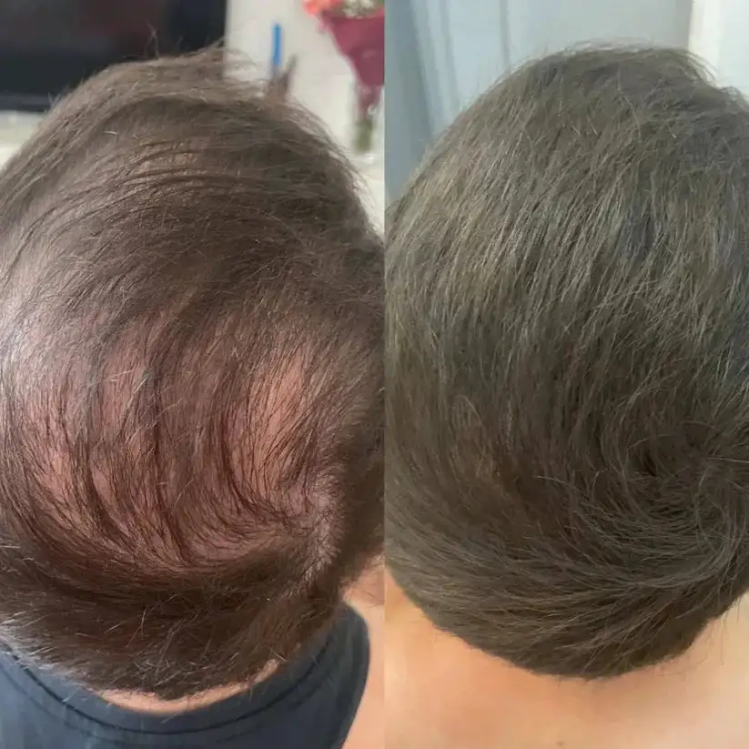 Misspone™ - Densify