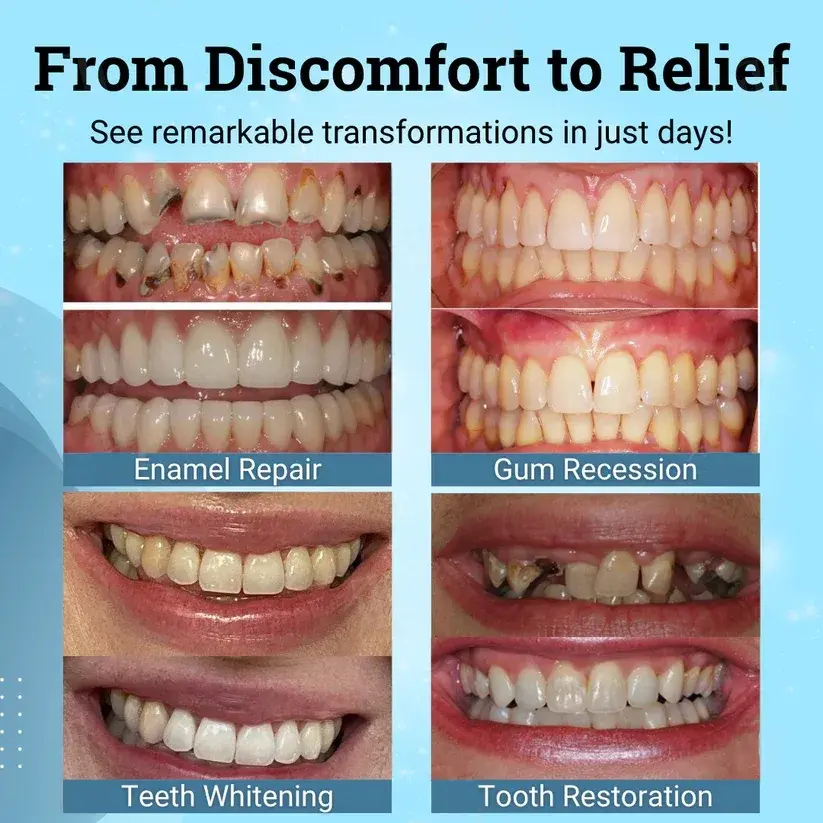 Natravor® Non-Surgical Gum "Suture" Gel