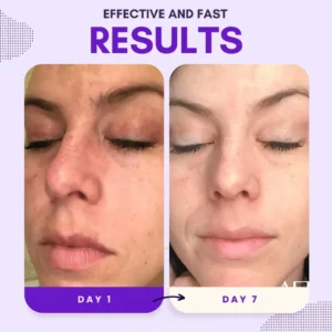 Natravor® Thiamidol 630 Serum