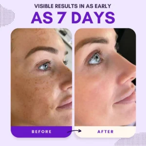 Natravor® Thiamidol 630 Serum