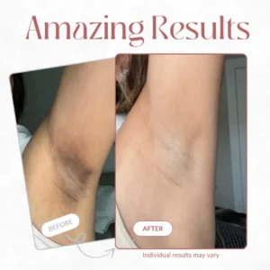 Peel Shot - Kojic + Turmeric Body Peel Spray