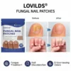 LOVILDS® FUNGAL NAIL PATCHES