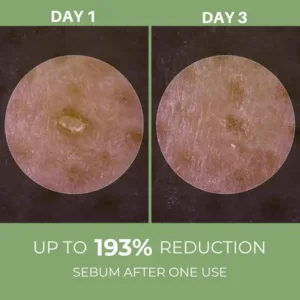 LOVILDS® Rice Peel Ampoule