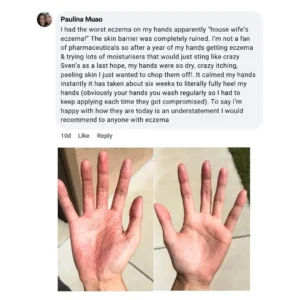 LOVILDS®The Steroid-Free Daily Cream for Eczema-Prone, Sensitive Skin