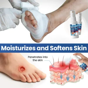 NESLEMY® Liquid Wound Film Spray