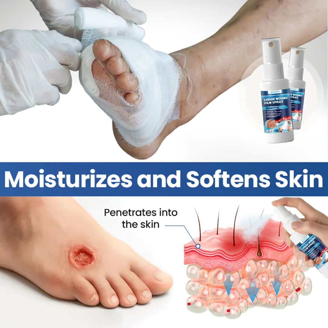 NESLEMY® Liquid Wound Film Spray