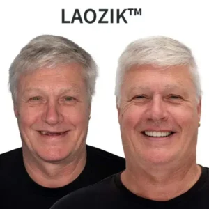 🔥 LAOZIKTM Custom-Fit Functional Dentures — Made in the USA, Up to 70% OFF for a More Confident Smile!
