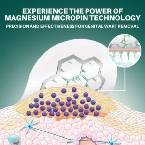 Alisanda™ Magnesium MicroPin HPV Genital Wart Removal Patch