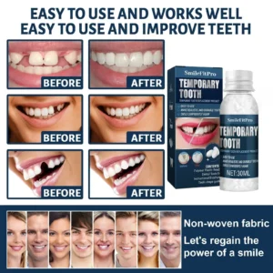 SmileFitPro™ Dental Filling Gel