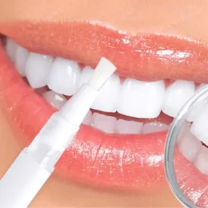 SmileFitPro™ Teeth Whitening Pen