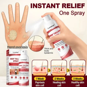 𝗟𝘂𝘅𝗮𝗿𝗶𝘀𝒆® 𝗕𝗲𝗲𝗳 𝗧𝗮𝗹𝗹𝗼𝘄 𝗦𝗽𝗿𝗮𝘆 𝗳𝗼𝗿 𝗜𝘁𝗰𝗵𝘆, 𝗙𝗹𝗮𝗸𝘆 𝗣𝘀𝗼𝗿𝗶𝗮𝘀𝗶𝘀 𝗦𝗸𝗶𝗻