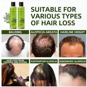 Alisanda® Organic Rosemary Hair Growth Shampoo