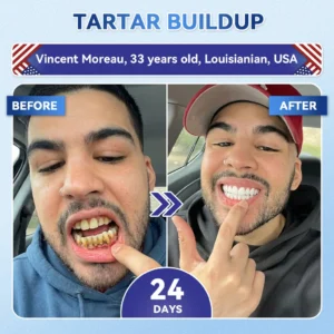 Your Smile~ SmileFitPro® 🦷 Tideglusib Fast‑Dissolving Tooth & Gum Repair Oral Strips ✨ (𝟓-𝐢𝐧-𝟏 💎 𝐑𝐞𝐛𝐮𝐢𝐥𝐝 𝐄𝐧𝐚𝐦𝐞𝐥 & 𝐃𝐞𝐧𝐭𝐢𝐧 • 𝐒𝐭𝐫𝐞𝐧𝐠𝐭𝐡𝐞𝐧 𝐆𝐮𝐦𝐬 • 𝐄𝐫𝐚𝐝𝐢𝐜𝐚𝐭𝐞 𝐓𝐚𝐫𝐭𝐚𝐫 & 𝐎𝐝𝐨𝐫 • 𝐖𝐡𝐢𝐭𝐞𝐧𝐢𝐧𝐠 • 𝐒𝐭𝐨𝐩 𝐓𝐨𝐨𝐭𝐡 𝐒𝐞𝐧𝐬𝐢𝐭𝐢𝐯𝐢𝐭𝐲)