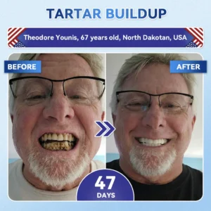 Your Smile~ SmileFitPro® 🦷 Tideglusib Fast‑Dissolving Tooth & Gum Repair Oral Strips ✨ (𝟓-𝐢𝐧-𝟏 💎 𝐑𝐞𝐛𝐮𝐢𝐥𝐝 𝐄𝐧𝐚𝐦𝐞𝐥 & 𝐃𝐞𝐧𝐭𝐢𝐧 • 𝐒𝐭𝐫𝐞𝐧𝐠𝐭𝐡𝐞𝐧 𝐆𝐮𝐦𝐬 • 𝐄𝐫𝐚𝐝𝐢𝐜𝐚𝐭𝐞 𝐓𝐚𝐫𝐭𝐚𝐫 & 𝐎𝐝𝐨𝐫 • 𝐖𝐡𝐢𝐭𝐞𝐧𝐢𝐧𝐠 • 𝐒𝐭𝐨𝐩 𝐓𝐨𝐨𝐭𝐡 𝐒𝐞𝐧𝐬𝐢𝐭𝐢𝐯𝐢𝐭𝐲)